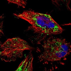 ETFB Antibody, Novus Biologicals 25 &mu;L; Unlabeled:Antibodies, Polyclonal